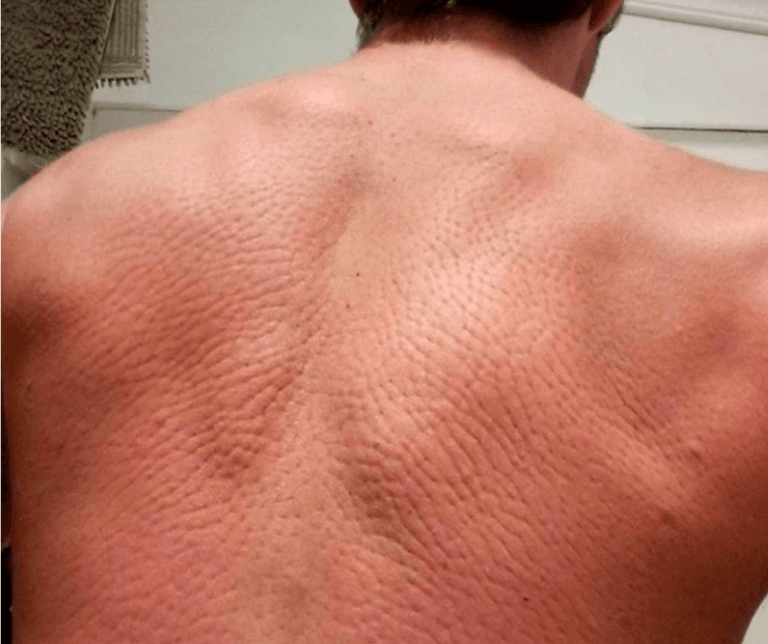 Trigger Points® Acupressure Set photo review