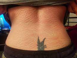 Trigger Points® Acupressure Set photo review