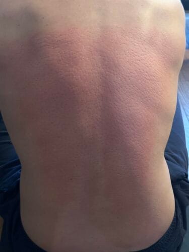 Trigger Points® Acupressure Set photo review