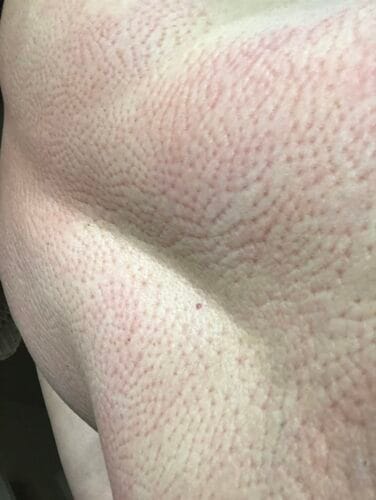 Trigger Points® Acupressure Set photo review