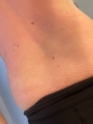 Trigger Points® Acupressure Set photo review