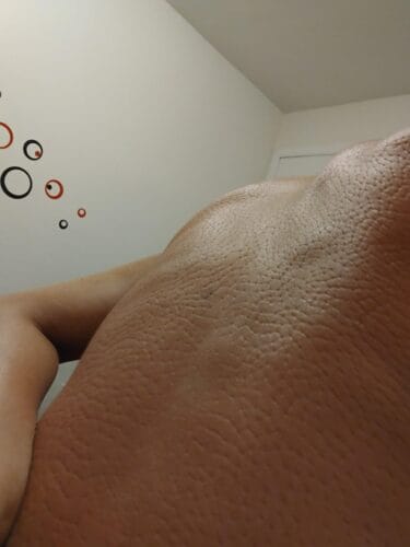 Trigger Points® Acupressure Set photo review