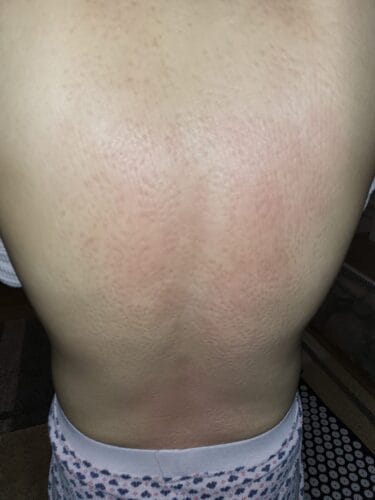 Trigger Points® Acupressure Set photo review
