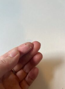 Watersonic - Ultrasonic Teeth Cleaner with Water Cooling photo review