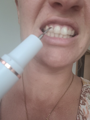 Watersonic - Ultrasonic Teeth Cleaner with Water Cooling photo review