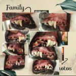 Watersonic - Ultrasonic Teeth Cleaner with Water Cooling photo review