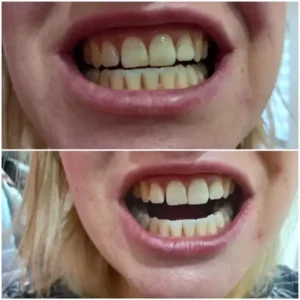 WaterSonic™ Ultrasonic Tartar Remover for Dogs photo review